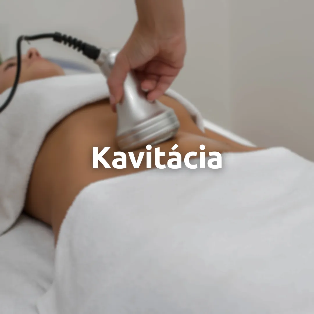 Kavitácia
