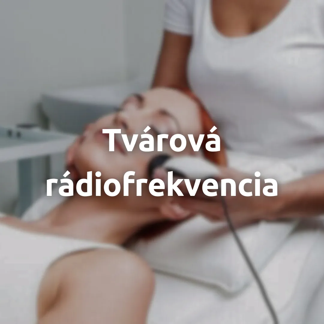 Tvárová rádiofrekvencia